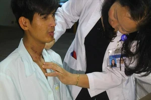 Chàng trai Campuchia hết cấm khẩu 2 năm nhờ bác sĩ Việt Nam