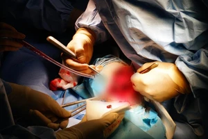 Bệnh nhân kêu mổ nhưng không cho truyền máu từ người khác