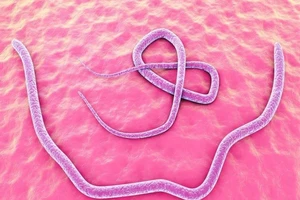 Những dấu hiệu nhận biết cơ thể bị nhiễm ký sinh trùng