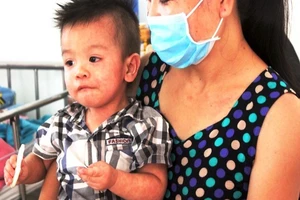 Tất tần tật cách phòng và chăm sóc bệnh sởi