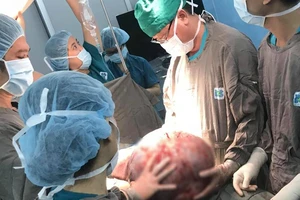 Bà mẹ phụ hồ 3 con mang khối u buồng trứng hơn 20 kg