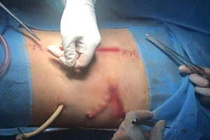 Kích hoạt báo động đỏ cứu thanh niên vỡ nhiều tạng nguy kịch