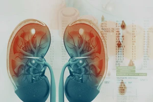 Những điều cần biết về suy thận và cách phòng ngừa