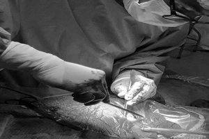 Cứu mẹ con sản phụ sinh mổ lần 2 bị nứt tử cung