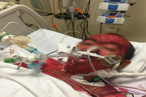 Gần 100 ngày cứu người đàn ông dị ứng hầu hết các loại thuốc 