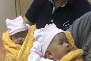 Ngắm vẻ đáng yêu của hai bé sinh đôi dính nhau khi xuất viện