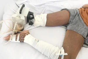 Nguy cơ đoạn 2 chân vì rắn cắn 1 chân, đi hút máu độc 2 chân