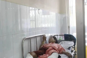 Tay chiết xăng miệng ngậm thuốc lá, 4 người bỏng nặng