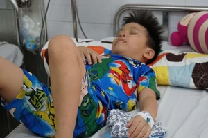 Thủng dạ dày và ruột vì 3 viên bi nam châm hít chặt nhau