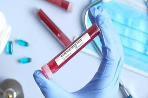 Danh sách 30 đơn vị đủ năng lực xét nghiệm COVID-19 