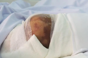 Uống thuốc truyền miệng, bệnh nhân tiểu đường mất mạng