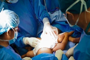 2 bé song sinh được tách rời hoàn toàn, chảy máu lượng ít