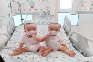 Trúc Nhi và Diệu Nhi được tháo hoàn toàn khung bột nẹp