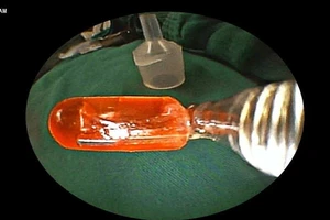 Bé gái 10 tháng tuổi đột nhiên ói liên tục vì lý do này 