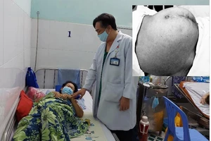 Ung thư giai đoạn muộn do bụng căng lên mà không đi khám 