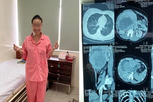 Đau như bị ai đâm sau lưng nhưng tưởng thủ phạm là mỡ