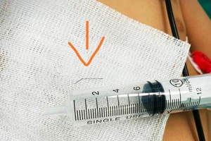 Lý do bất ngờ khiến bé trai đang ăn nhưng đột nhiên quấy khóc