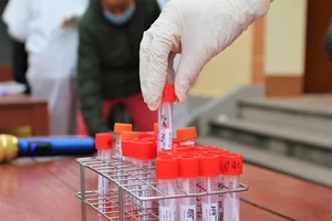 Bệnh nhân 1660 tại TP.HCM nhiễm biến thể siêu lây nhiễm 