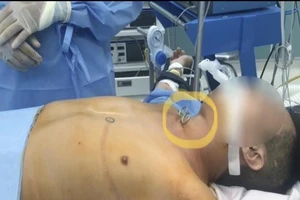 Cứu người đàn ông tự dùng kéo đâm vào cổ