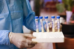 Ca nghi nhiễm COVID-19 ở quận Gò Vấp hai lần dương tính yếu