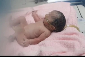 Cuộc chạy đua giữa đêm cứu nữ bác sĩ mắc COVID-19 ‘mẹ tròn con vuông’