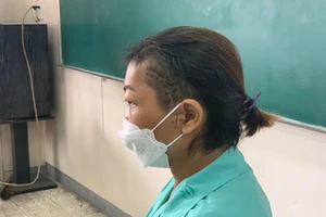 Sở Y tế TP.HCM yêu cầu báo cáo ca bệnh hoại tử xương hàm mặt sau mắc COVID-19