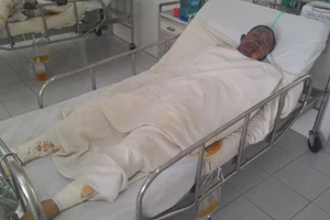 Thanh niên tạt xăng đốt cả bản thân để giải quyết mâu thuẫn