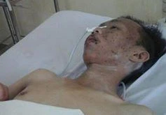 Mong phép màu đến với cậu sinh viên báo chí bị bệnh hiểm nghèo