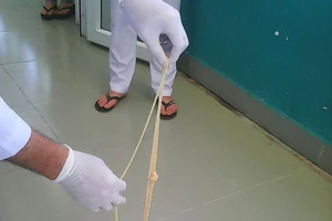 Lấy con sán xơ mít dài 8 m ra khỏi cơ thể bệnh nhân