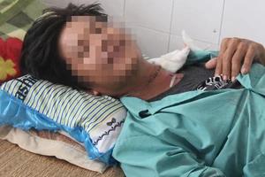 Người đàn ông nhập viện vì tự cứa cổ mình