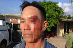 Một người đang 'tố' cán bộ nhận hối lộ bị đánh nhập viện