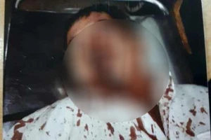 Bị vây đánh giữa đường nghi vì khoản nợ của vợ