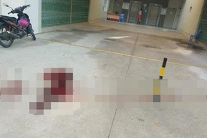 Bình Dương: Bảo vệ chung cư bị chém đứt lìa cánh tay