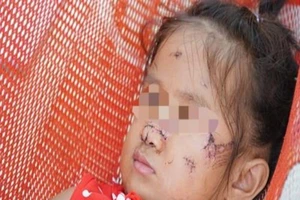 Chó hoang tấn công bé gái 2 tuổi tại Tây Ninh