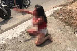 Phẫn nộ: Cô gái bị người tình cũ rạch mặt tàn ác