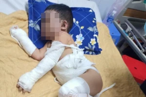 Bình Dương: 1 gia đình bị ném bom xăng, 2 bé trai bỏng nặng