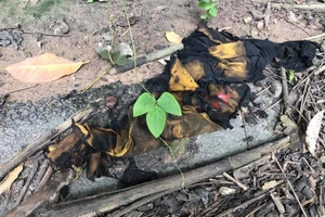 Bình Dương: Thiếu nữ 15 tuổi bị bạn trai tạt xăng đốt 