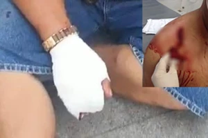 Bình Dương: Nhóm côn đồ hung hãn xông vào khu phong tỏa chém người