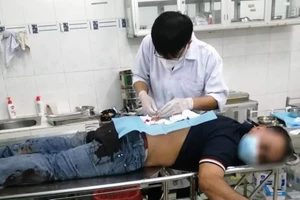 Cướp tấn công tài xế xe công nghệ bằng dao, lấy xe máy ở Bình Dương