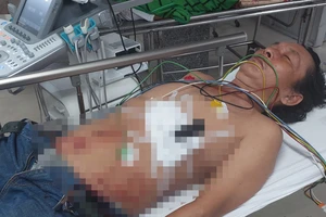 Nghi can giết người đang bỏ trốn bị dao đâm ở bụng, nghi tự sát