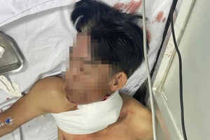 Bình Dương: Dùng dao tấn công bạn nhậu vì xin về giữa chừng