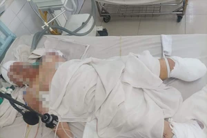 Thương tâm: Người đàn ông đang làm việc thì bị máy trộn bột cuốn vào 