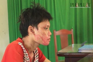 Tạt acid vào bạn gái sau khi đọc được tin nhắn 