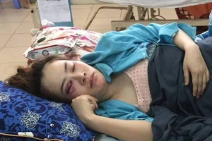 Cô gái bị đánh trong quán bánh xèo nộp đơn bãi nại