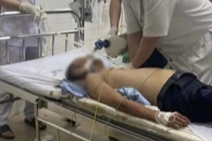 Bảo vệ ngân hàng bị cướp đâm chết có đủ điều kiện công nhận liệt sĩ? 