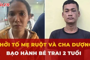 Khởi tố mẹ ruột và cha dượng bạo hành bé trai 2 tuổi đến đa chấn thương