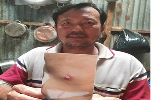 Làm rõ vụ dân tố bị cán bộ nổ súng bắn trúng lưng