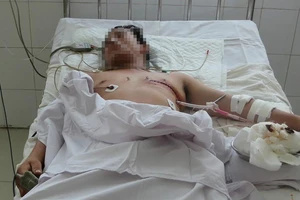 1 người bị đâm thủng tim ở Vĩnh Long