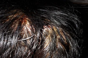 Xác minh vụ Công an tỉnh Kiên Giang bị tố đánh người