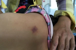 Điều tra vụ nữ học sinh nhập viện vì người lạ 'vỗ vai'